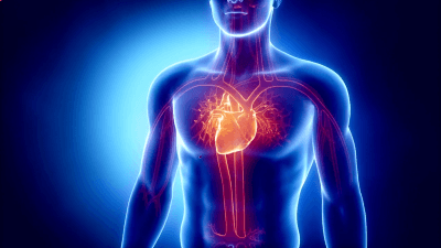 Advanced Interventional Cardiology image